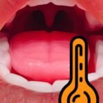 Oral Clamp Suction