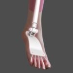 Toe Skeleton